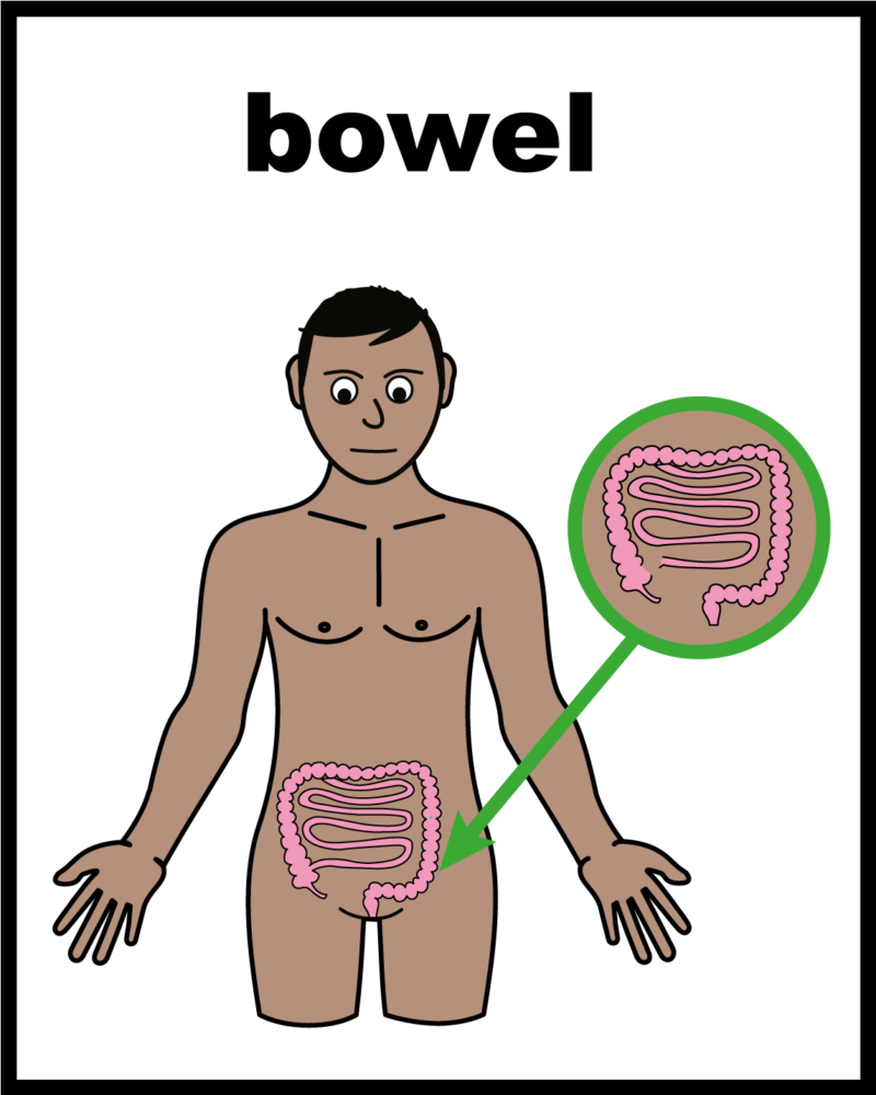 Graphic of man and arrow pointing to his bowel. Title reads: bowel